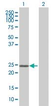 Anti-ZNF22 Mouse Polyclonal Antibody