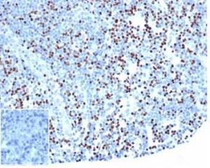 Anti-LEF1 antibody