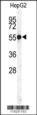 Anti-CTSH Rabbit Polyclonal Antibody