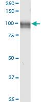 Anti-MME Polyclonal Antibody Pair