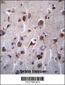 Anti-TMEM55B Rabbit Polyclonal Antibody (HRP (Horseradish Peroxidase))