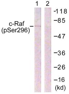 Western blot analysis of lysates from 293 cells treated with PMA 125 ng/ml 30' using Anti-C-RAF (phospho Ser296) Antibody. The right hand lane represents a negative control, where the Antibody is blocked by the immunising peptide