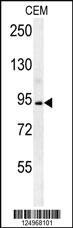 Anti-BCAN Rabbit Polyclonal Antibody