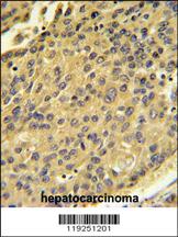 Anti-CTSH Rabbit Polyclonal Antibody