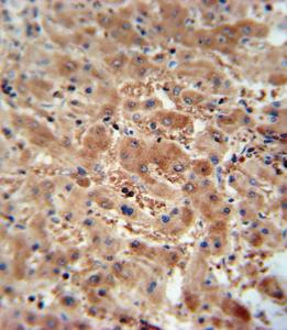 Anti-ASAP3 Rabbit Polyclonal Antibody