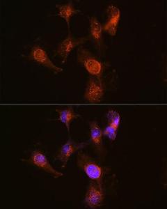 Immunofluorescence analysis of U-251 MG cells using Anti-ABCA7 Antibody (A308323) at a dilution of 1:100 (40x lens). DAPI was used to stain the cell nuclei (blue).