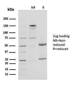 SDS-PAGE analysis of Anti-CD40L Antibody [CD40LG/2761] under non-reduced and reduced conditions; showing intact IgG and intact heavy and light chains, respectively SDS-PAGE analysis confirms the integrity and purity of the antibody