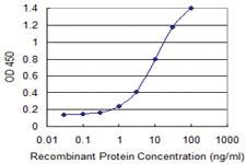 Anti-ZNF23 Mouse Monoclonal Antibody [clone: 2D3]