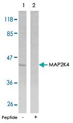 Anti-MAP2K4 Rabbit Polyclonal Antibody