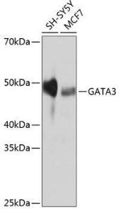 Anti-GATA3 Rabbit Monoclonal Antibody [clone: ARC0115]