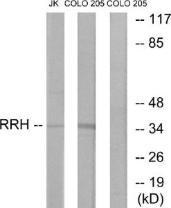 Anti-RRH antibody