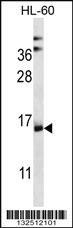 Anti-NDUFAF4 Rabbit Polyclonal Antibody