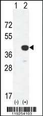 Anti-CTSK Rabbit Polyclonal Antibody