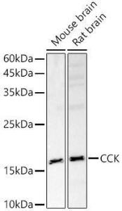 Western blot analysis of various lysates, using Anti-Cholecystokinin Antibody (A13637) at 1:500 dilution