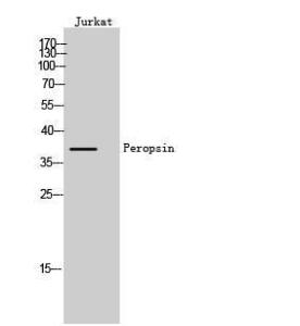 Anti-RRH antibody