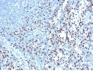 Anti-LEF1 antibody