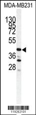 Anti-CTSS Rabbit Polyclonal Antibody