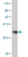 Anti-EPHB3 Mouse Monoclonal Antibody [clone: 1E12]