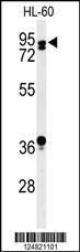 Anti-PATL1 Rabbit Polyclonal Antibody (FITC (Fluorescein Isothiocyanate))