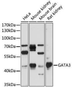 Anti-GATA3 Rabbit Polyclonal Antibody