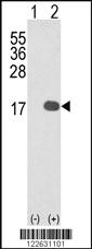 Anti-IL36B Rabbit Polyclonal Antibody