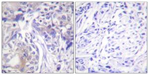 Antibody anti-ADD1 A96246-100 100 µg