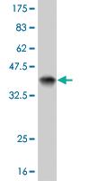 Anti-EPHB3 Mouse Monoclonal Antibody [clone: 2G9]