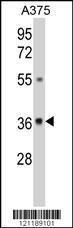 Anti-GALE Rabbit Polyclonal Antibody (Biotin)