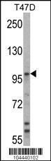 Anti-UBE3A Rabbit Polyclonal Antibody