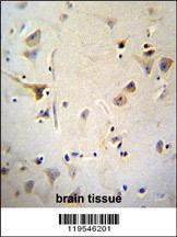 Anti-AGBL5 Rabbit Polyclonal Antibody (AP (Alkaline Phosphatase))