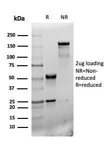 Anti-CD31 antibody