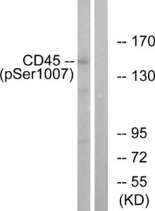 Immunofluorescence analysis of HeLa cells using Anti-CD45 (phospho Ser1007) Antibody. The right hand panel represents a negative control, where the Antibody was pre-incubated with the immunising peptide