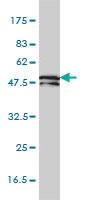 Anti-CK81 Mouse Monoclonal Antibody [clone: 3B10-5B10]