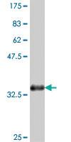 Anti-ZBTB16 Mouse Polyclonal Antibody