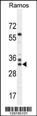 Anti-FAM133A Rabbit Polyclonal Antibody (APC (Allophycocyanin))