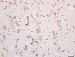 Anti-MCHR1 Rabbit Polyclonal Antibody