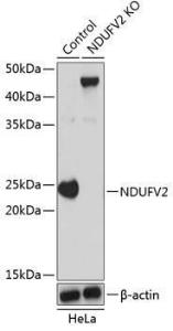 Anti-NDUFV2 Rabbit Polyclonal Antibody