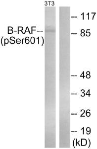 Antibody anti-B-RAF phospho SER602 100 µg