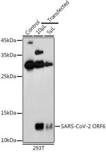 Western blot analysis of extracts of 293T cells, using Anti-SARS-CoV-2 ORF6 Antibody (A307318) at 1:1,000 dilution The secondary antibody was Goat Anti-Rabbit IgG H&L Antibody (HRP) at 1:10,000 dilution Lysates/proteins were present at 25 µg per lane