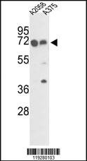 Anti-FKBP10 Rabbit Polyclonal Antibody