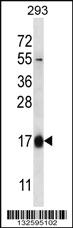 Anti-HBQ1 Rabbit Polyclonal Antibody