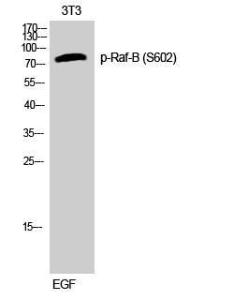 Antibody anti-B-RAF phospho SER602 100 µg