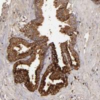 Anti-CFB Rabbit Polyclonal Antibody