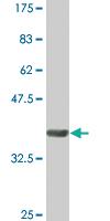 Anti-EPHB3 Mouse Monoclonal Antibody [clone: 2G8]