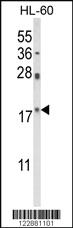 Anti-PIN1 Rabbit Polyclonal Antibody