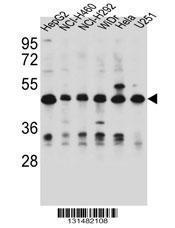 Anti-DUS1L Rabbit Polyclonal Antibody