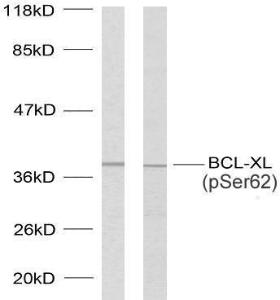 Western blot analysis of lysates from 293 cells treated with UV and MDA MB 435 cells treated with UV using Anti-BCL-XL (phospho Ser62) Antibody