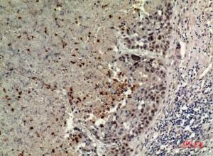 Immunohistochemical analysis of paraffin-embedded human lung using Anti-BCAT1 Antibody