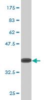 Anti-ZBTB16 Mouse Monoclonal Antibody [clone: 1F10]