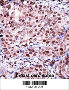 Anti-TERF2IP Rabbit Polyclonal Antibody (AP (Alkaline Phosphatase))